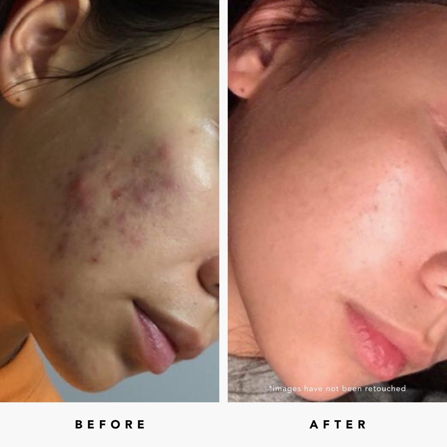 BLUE TANSY Invisible Pores Resurfacing Clarity Mask | Herbivore Botanicals