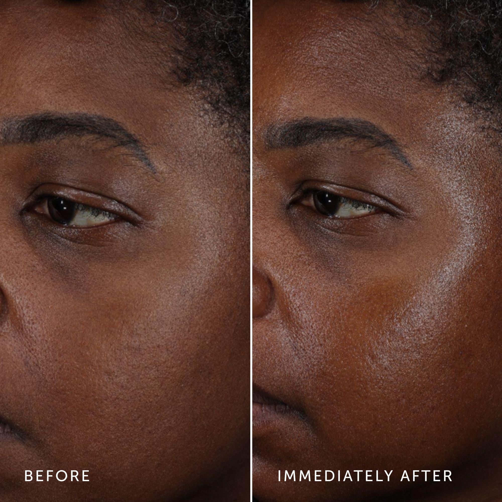 Before and after comparison of a person's face with visible skin texture changes.