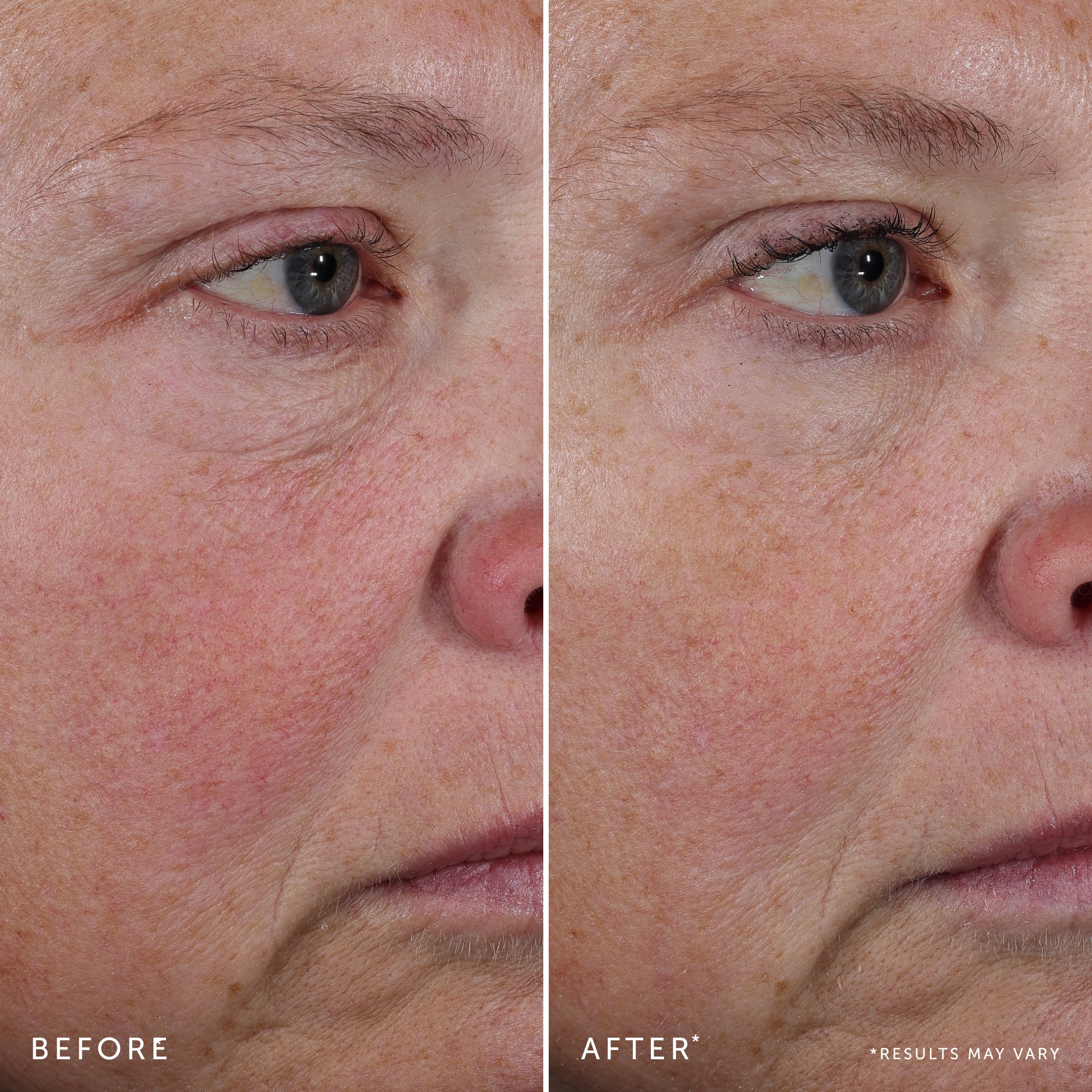 BAKUCHIOL Dual-Retinol Alternative Serum