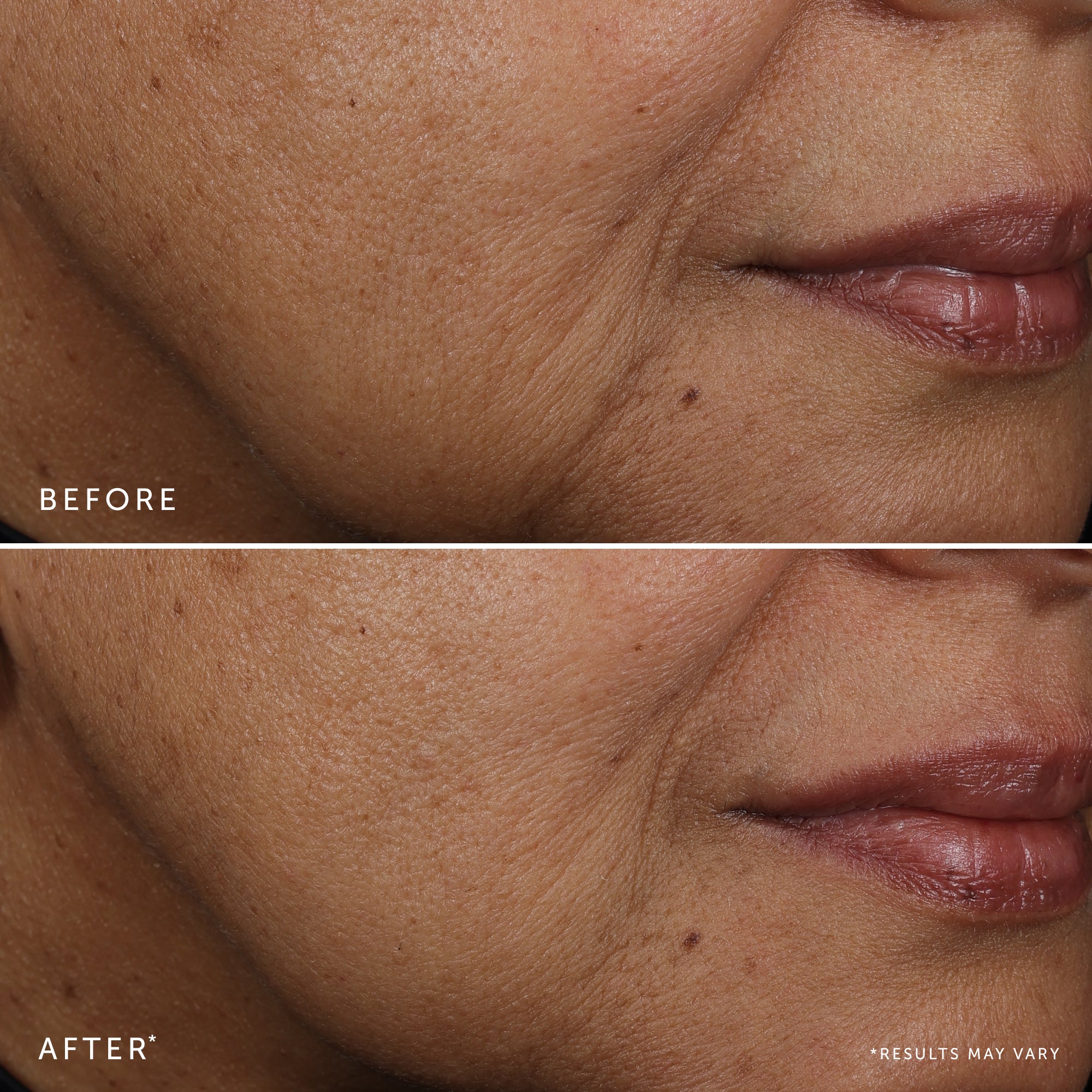 BAKUCHIOL Dual-Retinol Alternative Serum