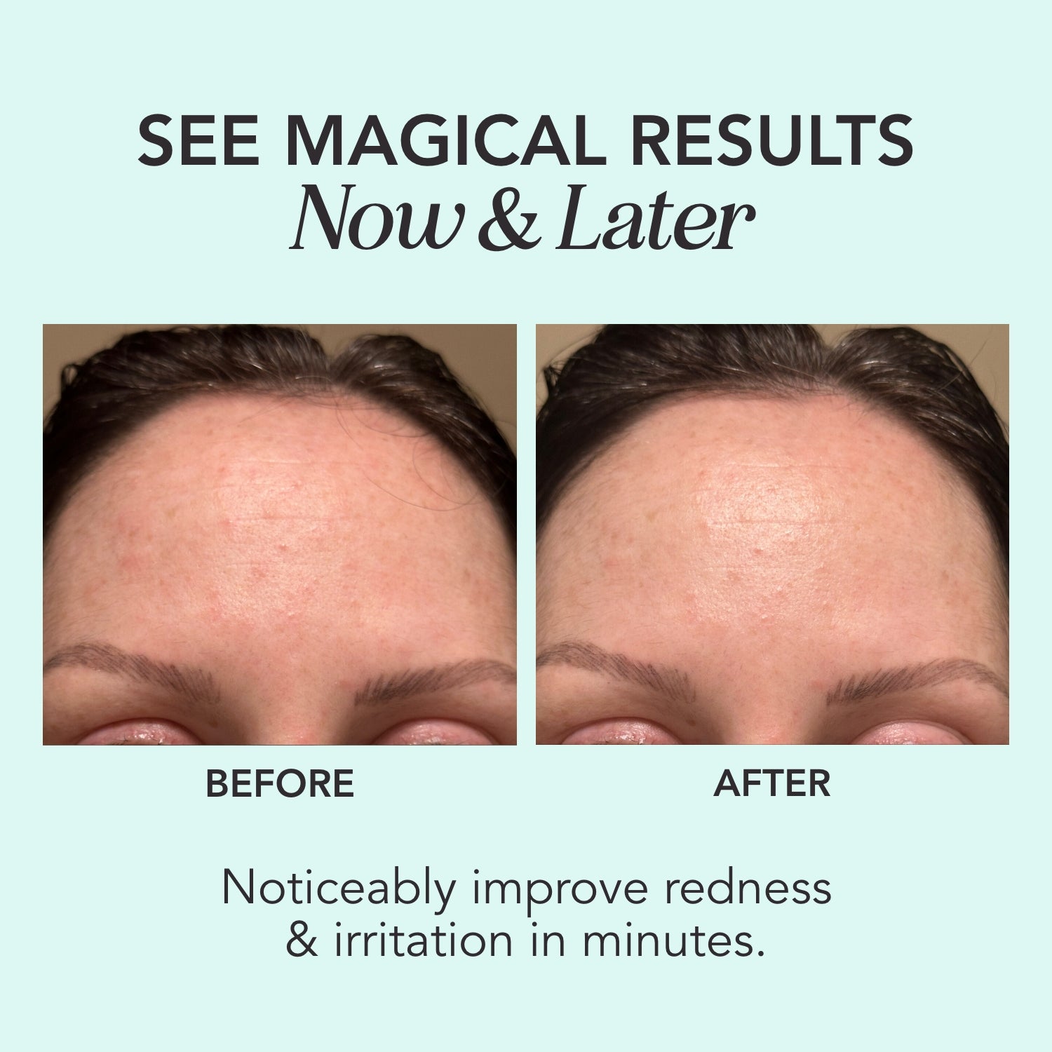 Before and After results showing the redness-reducing benefits of Green Magic Serum