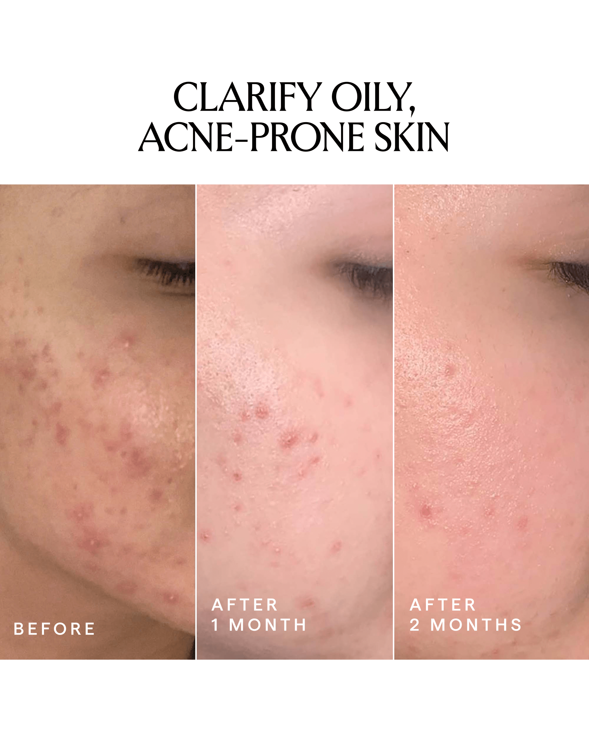 LAPIS Blue Tansy + Squalane Balancing Facial Oil