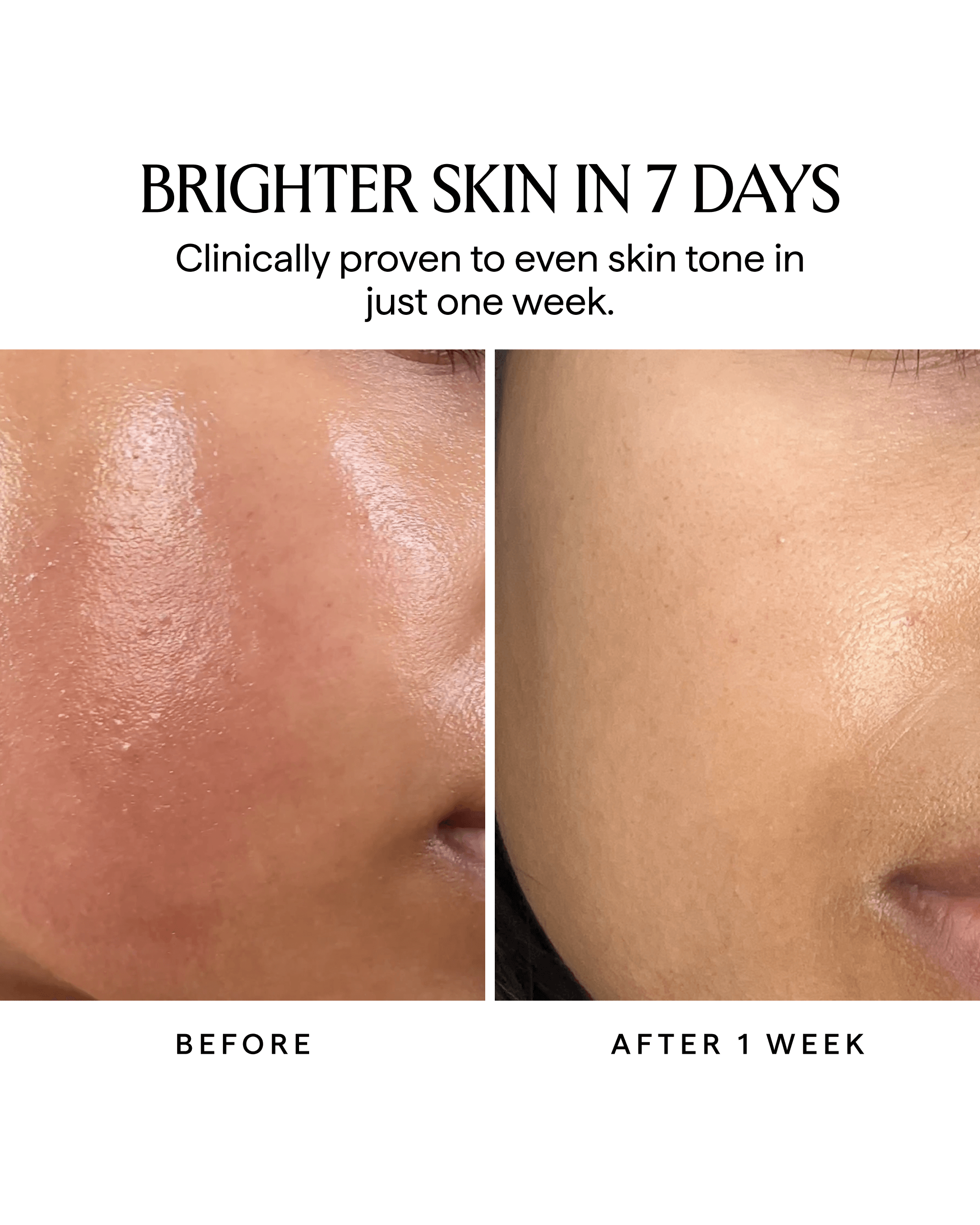 NOVA 15% Vitamin C + Turmeric Brightening Face Serum