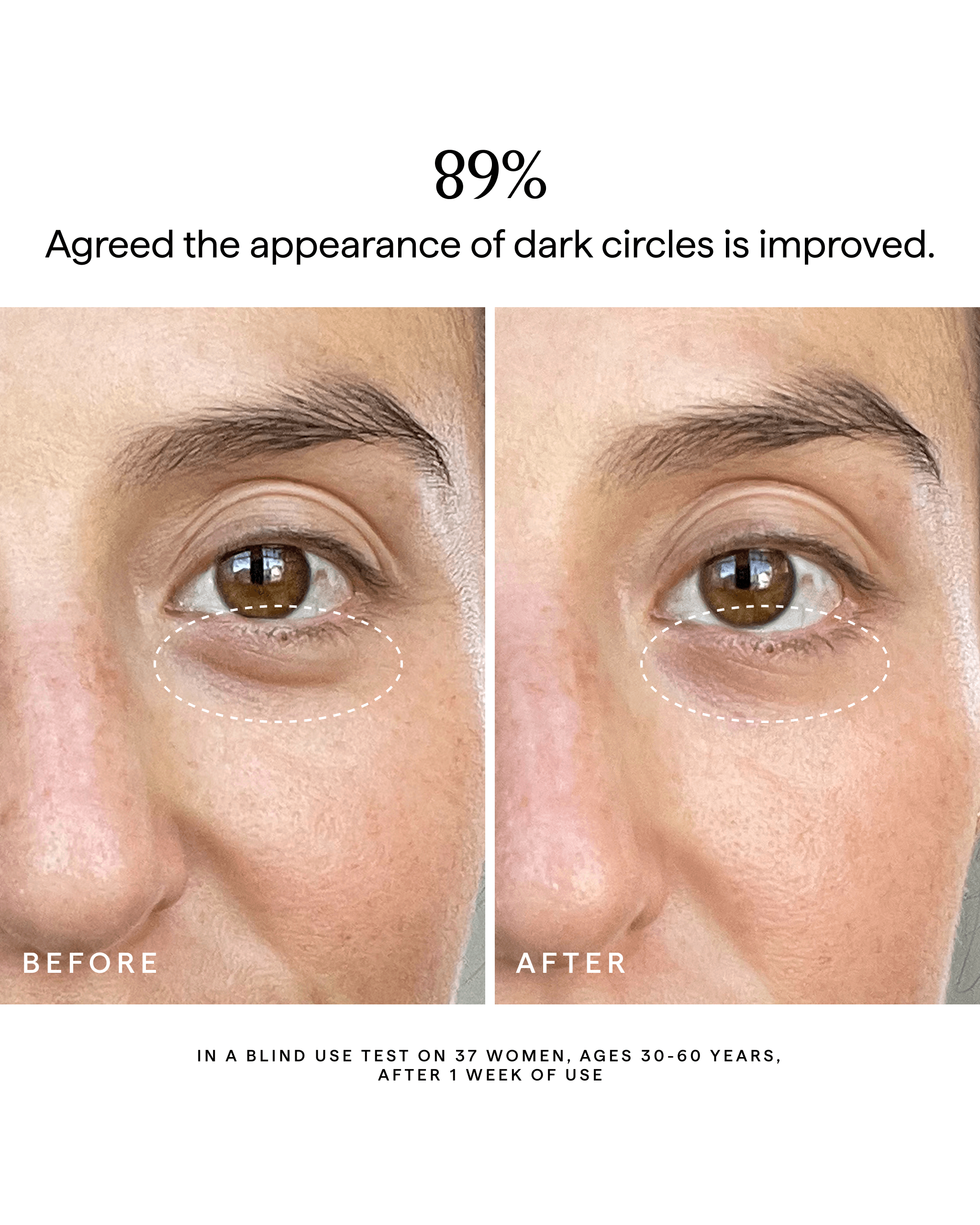 SUPER NOVA 5% Vitamin C + Caffeine Brightening Eye Cream